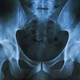 Illustration for article titled How Bones Affect Boners
